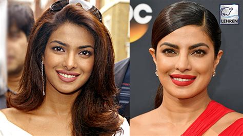 Priyanka Chopra Before And After