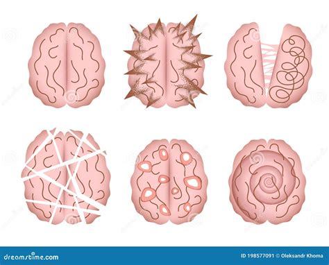 Representaciones Abstractas Del Cerebro Humano Alterado Por Varias