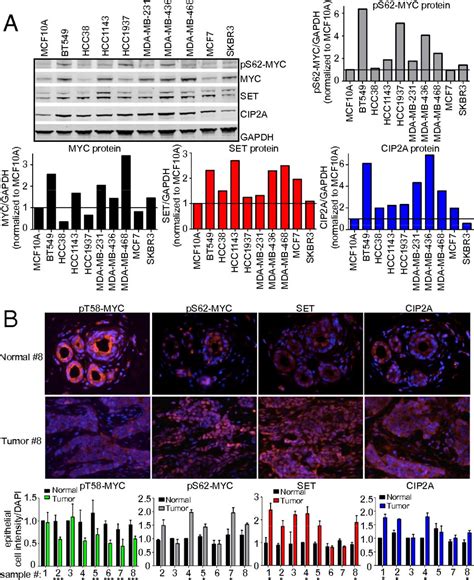 Targeting C MYC By Antagonizing PP2A Inhibitors In Breast Cancer PNAS