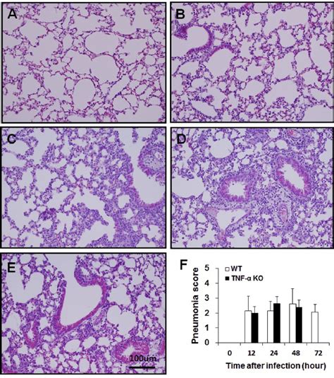 Histopathological Analysis Of Lungs From Wt And Tnf α Ko Mice After