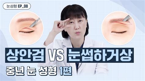 위버스성형외과 상안검 Vs 눈썹하거상 중년눈성형 하나만 선택한다면 Youtube