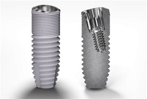 Deep Conical Implants Southern Implants