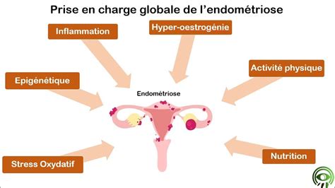 Accompagnement de l endométriose avec la naturopathie YouTube