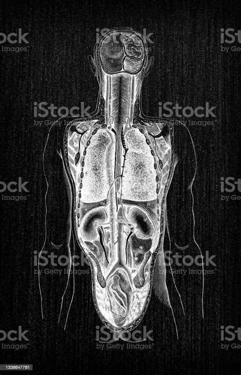 Antike Darstellung Der Anatomie Des Menschlichen Körpers Zurück Stock