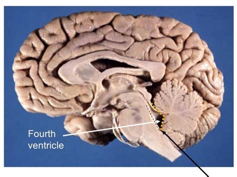 Neuro Anatomy Flashcards Quizlet