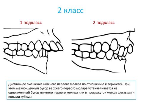 Введение в ортодонтию - online presentation