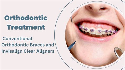 Orthodontic Treatment Conventional Orthodontic Braces And Invisalign