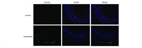 The Apoptosis Determination By Tunel Assay And Dapi Staining In The