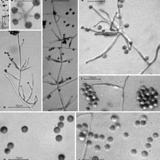 Pdf Pochonia Globispora Sp Nov