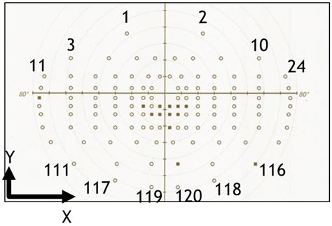 Diagnostics Free Full Text Reliability Of Binocular Esterman Visual