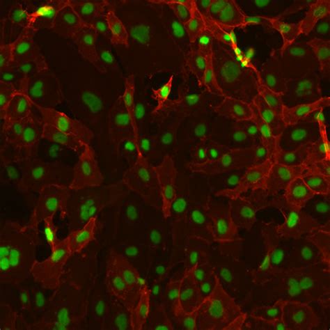 Human Endometrial Microvascular Endothelial Cells Innoprot Uterus Cells