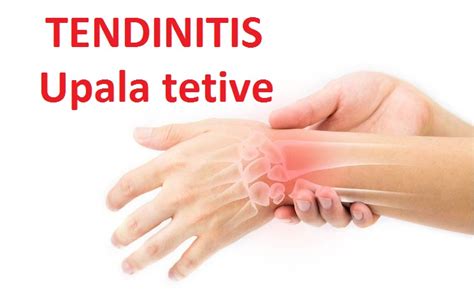 Tendinitis upala tetiva ruke ramena lakta simptomi uzrok i lečenje