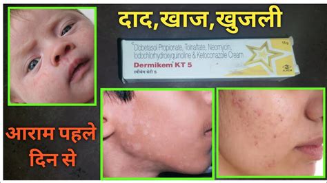 Dermikem Kt 5 Creambest Antifungal Creamदादखुजली को जड़ से ख़त्म करे