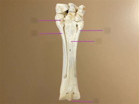 Metacarpus Palmar Diagram Quizlet