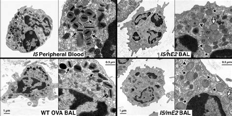 Eosinophil Electron Micrograph