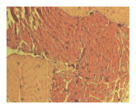 Histopathological Change In Rat Arthrodial Cartilage Photomicrographs