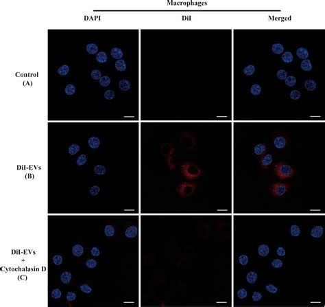 Frontiers Extracellular Vesicles Derived From Talaromyces Marneffei