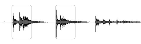 Hearing Aids Resound Impulse Noise Reduction