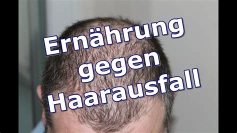 Ern Hrung Gegen Haarausfall Vitamine Mineralstoffe Co Youtube