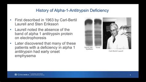 Alpha 1 Lung And Liver 101 March 20 2021 Virtual Alpha 1 Education Day Alpha 1 Foundation