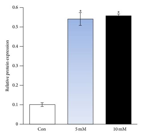 Hcy Increased Hsp Expression In Huvecs A Western Blot Analyses Of