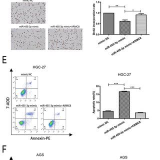 MiR 455 3p Functions As A Tumor Suppressor Via Targeting ARMC8 In