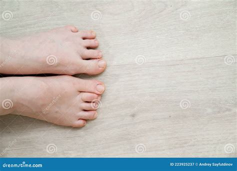 Unusual Foot Very Small Little Finger On The Leg Orthopedic