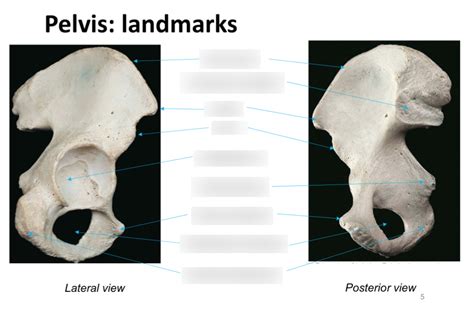 Diagram Of Pelvis Bony Landmarks Wk 10 Quizlet