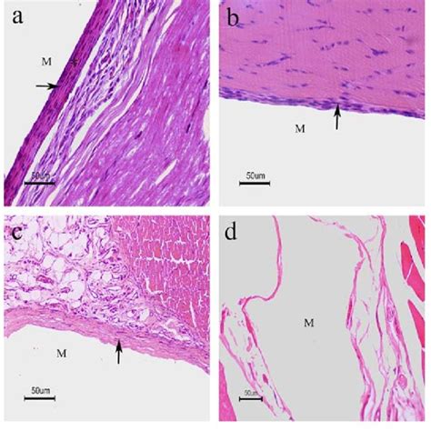 Photomicrographs Of Haematoxylin And Eosin Stained Sections Of