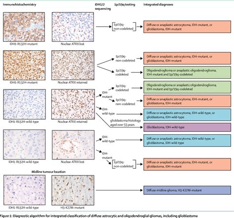 Figure From European Association For Neuro Oncology Eano Guideline