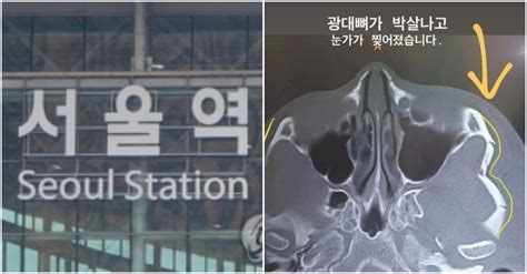 경찰 서울역 묻지마 폭행 용의자 자택서 검거 Snsfeed 제휴콘텐츠 제공 실시간 핫이슈