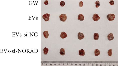 BMSC EVs Promoted Tumor Growth Via The MiR 877 3p CREBBP Axis By