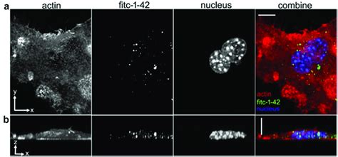 Bv2 Microglial Cell Phagocytosis Of Aβ1 42 Non Stimulated Bv2 Cells