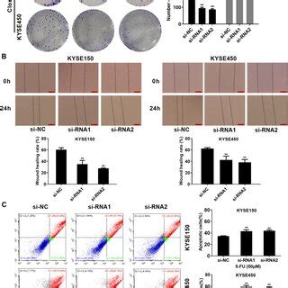 Snhg Regulates The Ezh Stat Pathway In Ec Cells A Role Of Si Rnas