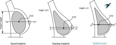 I Almost Got A Boob Job Good Idea Or No R Tiktokporn