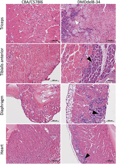 Representative Images Of H E Stained Muscles Muscle Fibres Of Control