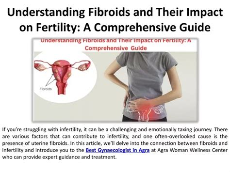 Ppt Understanding Fibroids And Their Relationship To Fertility