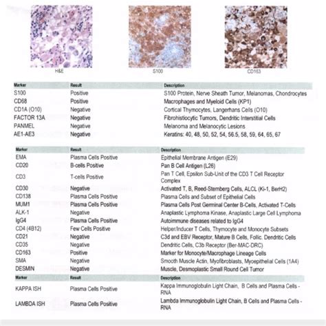 Imaging Depicts Multiple Subcutaneous Soft Tissue Nodules Noted In The Download Scientific