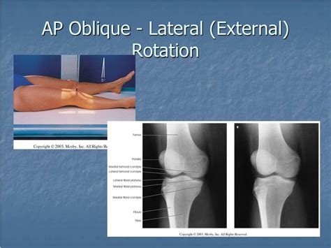 Ppt Positioning Review Of Upper And Lower Extremities Powerpoint