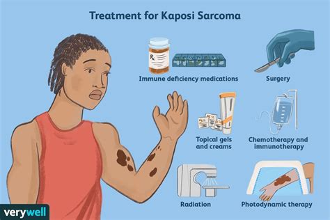 Comment Le Sarcome De Kaposi Est Trait Fmedic