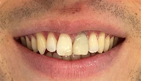 Urgencias dentales en Vitoria Clínica Dental Amalthea