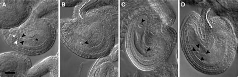 Embryo Sac Development Is Compromised In Cdt1a Mutants A Mature