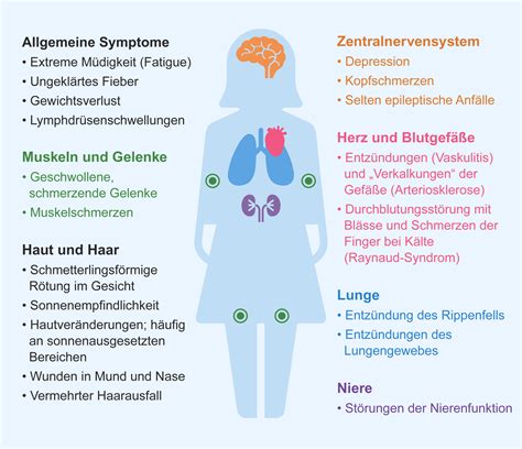 Roxanne French Viral Lupus Erythematodes Haut Behandlung