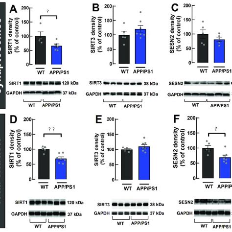 Synaptic transmission and plasticity in the dorsal hippocampus ... 