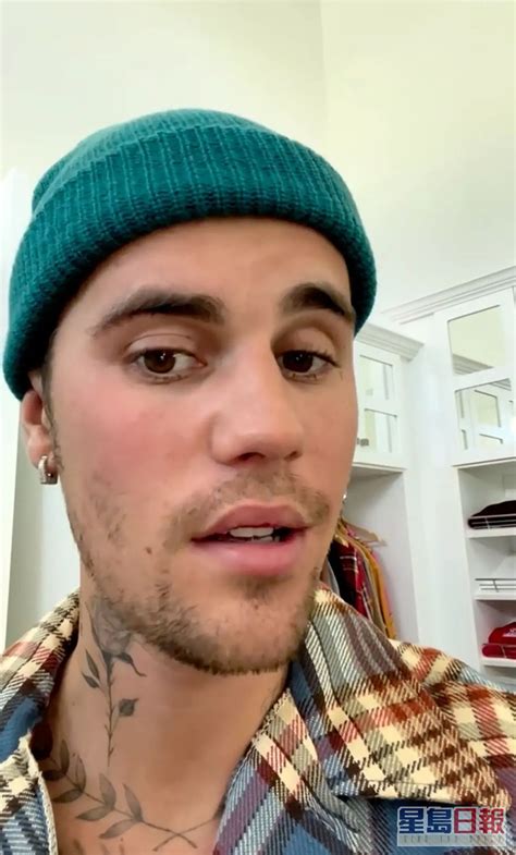 Justin Bieber患罕見病致面癱 無奈取消巡唱向fans道歉 星島日報