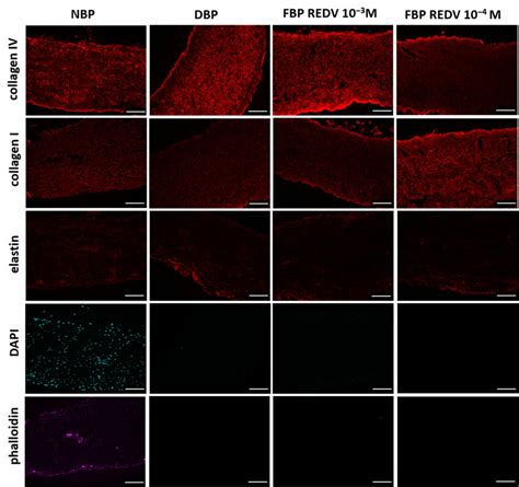 Immunofluorescence staining rows report the specific staining, while ...