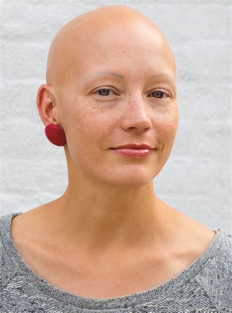 Author Helen Phillips On Living With Alopecia Refinery Uk Bald