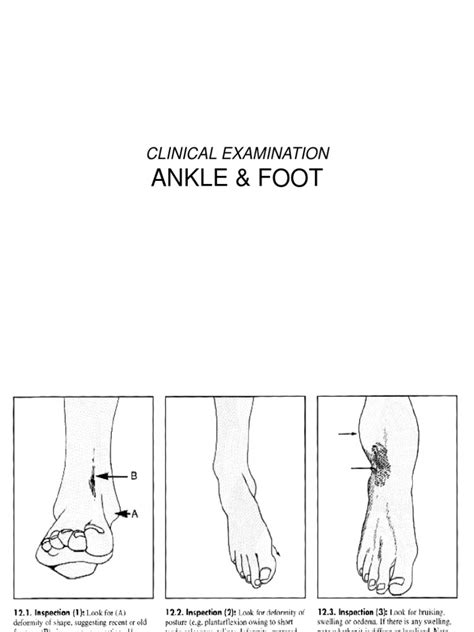 Physical Examination Of The Ankle And Foot Johanesppt Ankle Foot