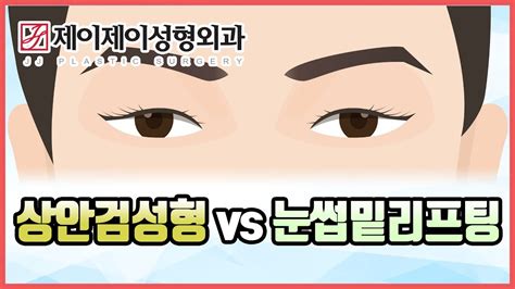 상안검성형 Vs 눈썹밑리프팅 Youtube