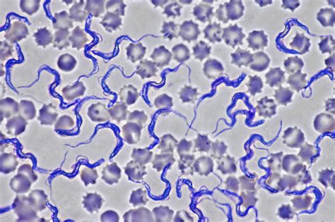Trypanosoma Brucei Smear Light Micrograph Stock Image C0526876